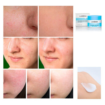 Крем для обличчя LANBENA Cream 50 г Hyaluronic Acid регенірація та відновлення шкіри фото №3