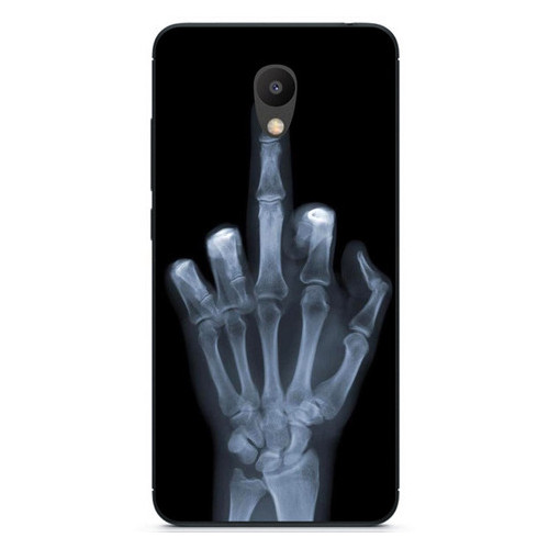Силіконовий бампер Coverphone Meizu M5s із малюнком Рентген фото №1